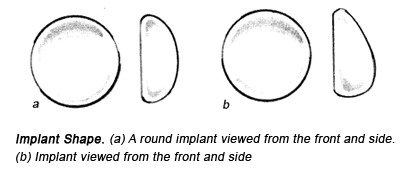 Teardrop vs Round Implants